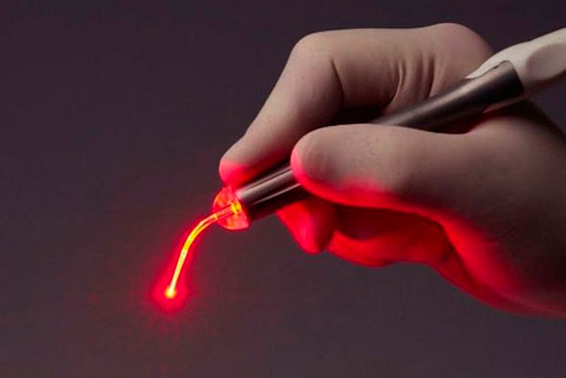 Laserkirurgi